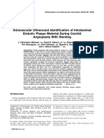 Case Reports Intravascular Ultrasound Identification of Intraluminal Embolic Plaque Material During Carotid Angioplasty With Stenting