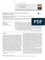 Imaging Fast Electrical Activity in The Brain With Electrical Impedance Tomography