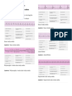 ACLS Pre Test Answers