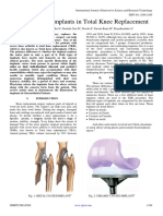 Illustration of Implants in Total Knee Replacement