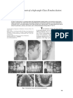 Arco Extraoral Caso Clinico