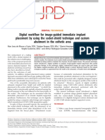 Digital Work Ow For Image-Guided Immediate Implant Placement by Using The Socket-Shield Technique and Custom Abutment in The Esthetic Area