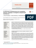 Las Diferentes Manifestaciones de La Aspergilosis Pulmonar. Hallazgos en Tomografía Computarizada Multidetector