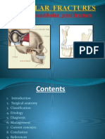 Condylar Fracture 3