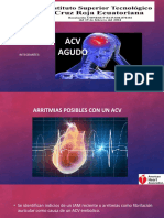 Acv Agudo