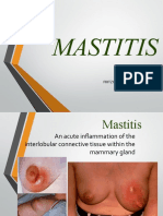 Mastitis