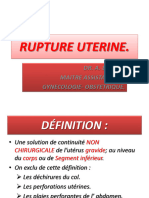 Rupture Uterine