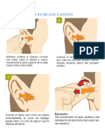 Uso Correcto de Los Tapones Auditivos