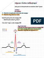 Interpretación ECG