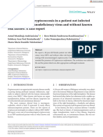 Artigo Neuromeningeal Cryptococcosis in A Patient Not Infected With Human