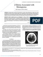 Cerebral Edema Associated With Meningioma