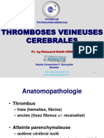 Thromboses Veineuses Cerebrales: Pr. Ag Mohamed Habib GRISSA