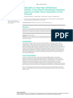 Bradycardia As A Rare Sign of Pulmonary Embolism