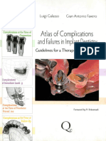 Atlas of Complications and Failures in Implant Dentistry