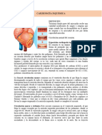 Cardiopatía Isquemica