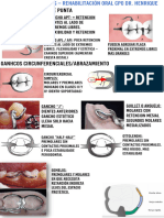 Resúmen Ganchos PPR Rehabilitación Oral