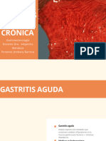 Gastritis Aguda y Crónica