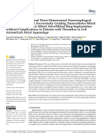 2D 3D TEE Transcatheter Guiding With LAA Thrombus