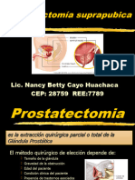 Prostatectomia ULTIMOS AVANCES