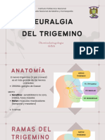 Neuralgia Del Trigemino