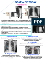 Radiografia de Torax