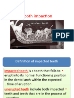 DR - Fidaa Impaction-1