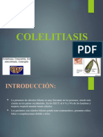 COLELITIASIS