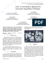 Parastomal Hernia: A Case Report, Repaired by Modified Laparascopic Sugarbaker Technique