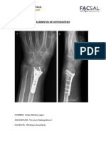 Elementos de Osteosíntesis - Felipe Mérida