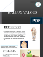 Hallux Valgus