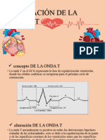 Diapositiva Onda T