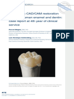 Biomimetic CAD - CAM Restoration