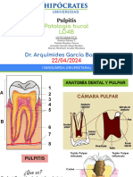 Pulpitis