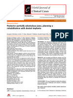 1 Posterior Partially Edentulous Jaws, Planning A