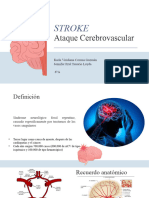 Stroke Neurología