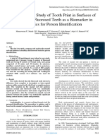 A Comparative Study of Tooth Print in Surfaces of Normal and Fluorosed Teeth As A Biomarker in Forensics For Person Identification