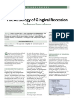 The Aetiology of Gingival Recession