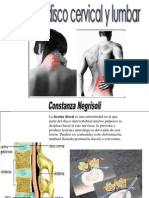 Hernia de Disco Cervical y Lumbar