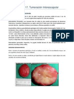 Caso #17. Tumoración Interescapular