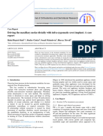 Driving The Maxillary Molar Distally With Infra-Zygomatic Crest Implant: A Case