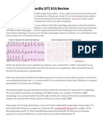 Cardiology Help Sheet