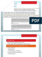 Taquicardia Ventricular