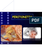 Peritonitis!!!!