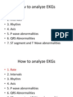 How To Analyze Ekgs