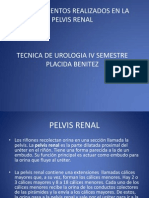 Procedimientos en La Pelvis Renal