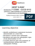 CHEST X-RAY Presentation CVS