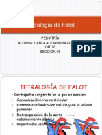 Tetralogía de Falot