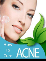 How To Cure Acne