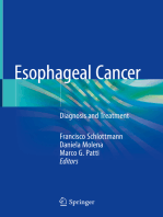 Esophageal Cancer: Diagnosis and Treatment