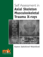 Self Assessment in Axial Skeleton Musculoskeletal Trauma X-rays